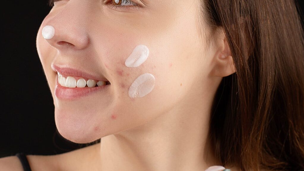 skin medica tns ceramide treatment cream
