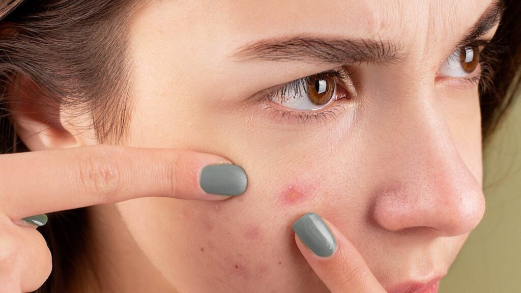 skin script blemish spot treatment